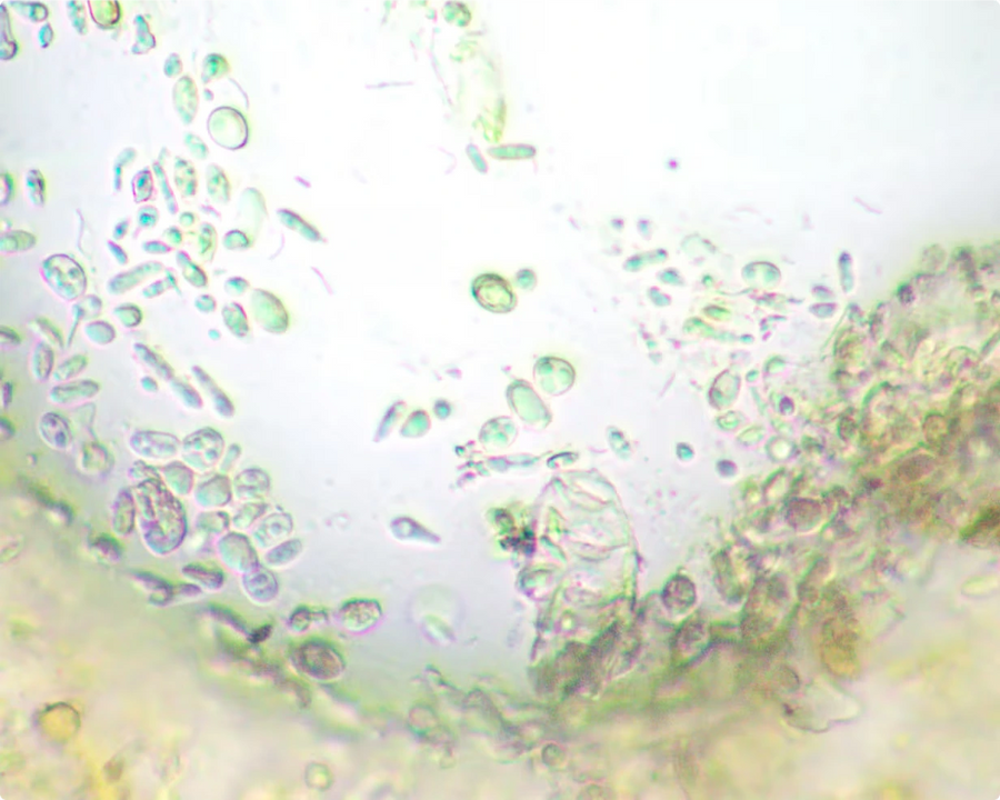 Postbiotics